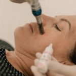 A woman receiving a facial microdermabrasion treatment in a spa setting.